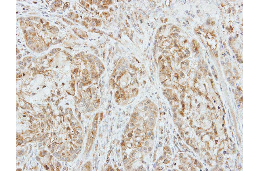 Immunohistochemistry - Factor X antibody from Signalway Antibody (22993) - Antibodies.com