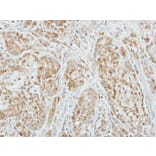 Immunohistochemistry - Factor X antibody from Signalway Antibody (22993) - Antibodies.com