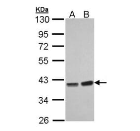 PP1 gamma antibody from Signalway Antibody (23054) - Antibodies.com