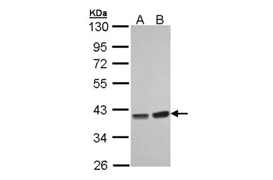 PP1 gamma antibody from Signalway Antibody (23054) - Antibodies.com