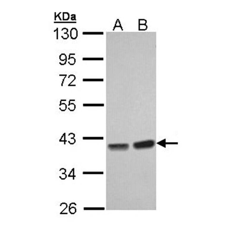 PP1 gamma antibody from Signalway Antibody (23054) - Antibodies.com