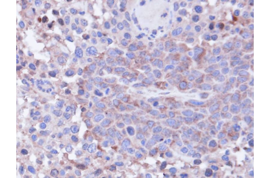 Immunohistochemistry - PP1 gamma antibody from Signalway Antibody (23054) - Antibodies.com