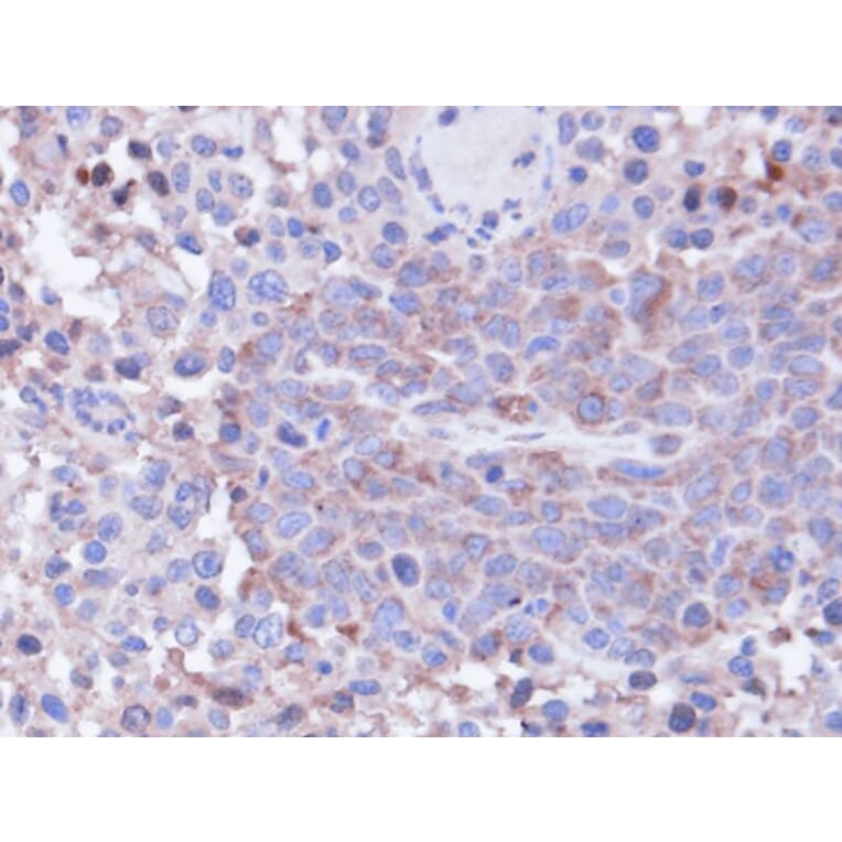 Immunohistochemistry - PP1 gamma antibody from Signalway Antibody (23054) - Antibodies.com