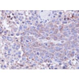 Immunohistochemistry - PP1 gamma antibody from Signalway Antibody (23054) - Antibodies.com
