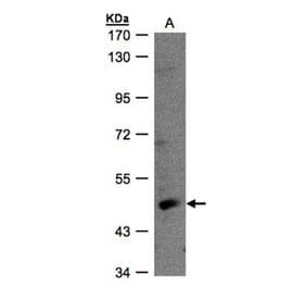 RAR-gamma antibody from Signalway Antibody (23066) - Antibodies.com