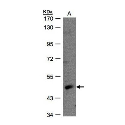 RAR-gamma antibody from Signalway Antibody (23066) - Antibodies.com