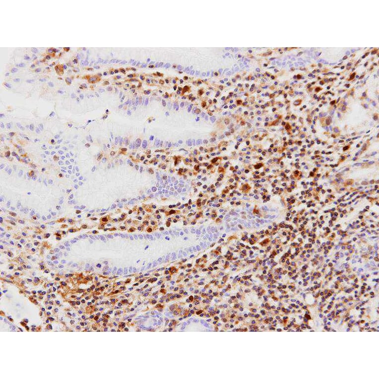 Immunohistochemistry - RAR-gamma antibody from Signalway Antibody (23066) - Antibodies.com