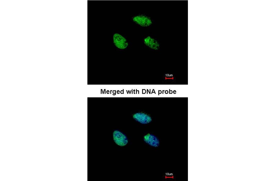 Immunofluorescence - RAR-gamma antibody from Signalway Antibody (23066) - Antibodies.com