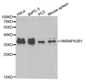Western blot - HNRNPA2B1 Antibody from Signalway Antibody (32193) - Antibodies.com