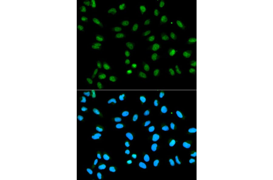 Immunofluorescence - HNRNPA2B1 Antibody from Signalway Antibody (32193) - Antibodies.com