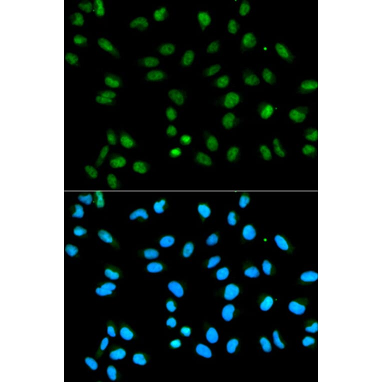 Immunofluorescence - HNRNPA2B1 Antibody from Signalway Antibody (32193) - Antibodies.com