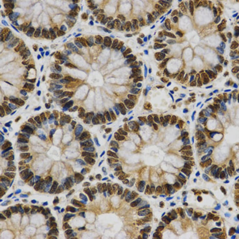 Immunohistochemistry - HNRNPA2B1 Antibody from Signalway Antibody (32193) - Antibodies.com