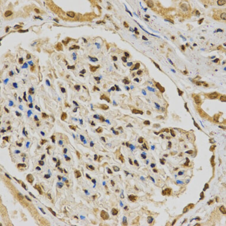 Immunohistochemistry - HNRNPA2B1 Antibody from Signalway Antibody (32193) - Antibodies.com
