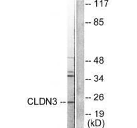 Western blot - Claudin 3 Antibody from Signalway Antibody (33334) - Antibodies.com