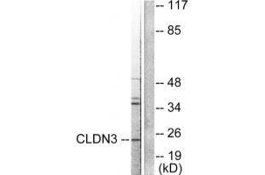 Western blot - Claudin 3 Antibody from Signalway Antibody (33334) - Antibodies.com