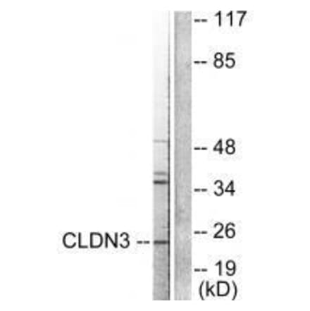 Western blot - Claudin 3 Antibody from Signalway Antibody (33334) - Antibodies.com