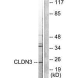 Western blot - Claudin 3 Antibody from Signalway Antibody (33334) - Antibodies.com