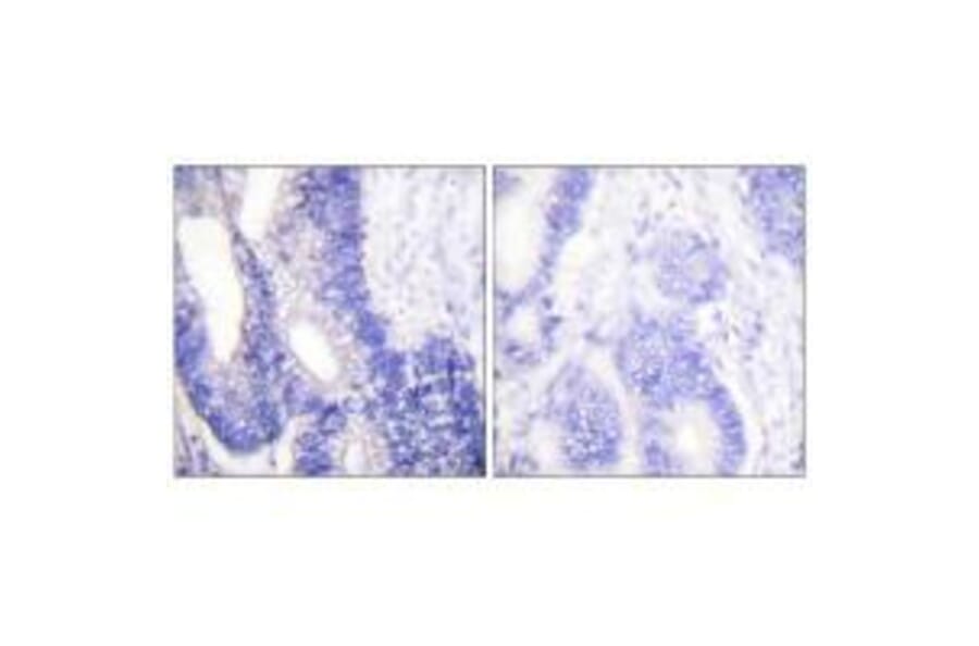 Immunohistochemistry - Claudin 3 Antibody from Signalway Antibody (33334) - Antibodies.com