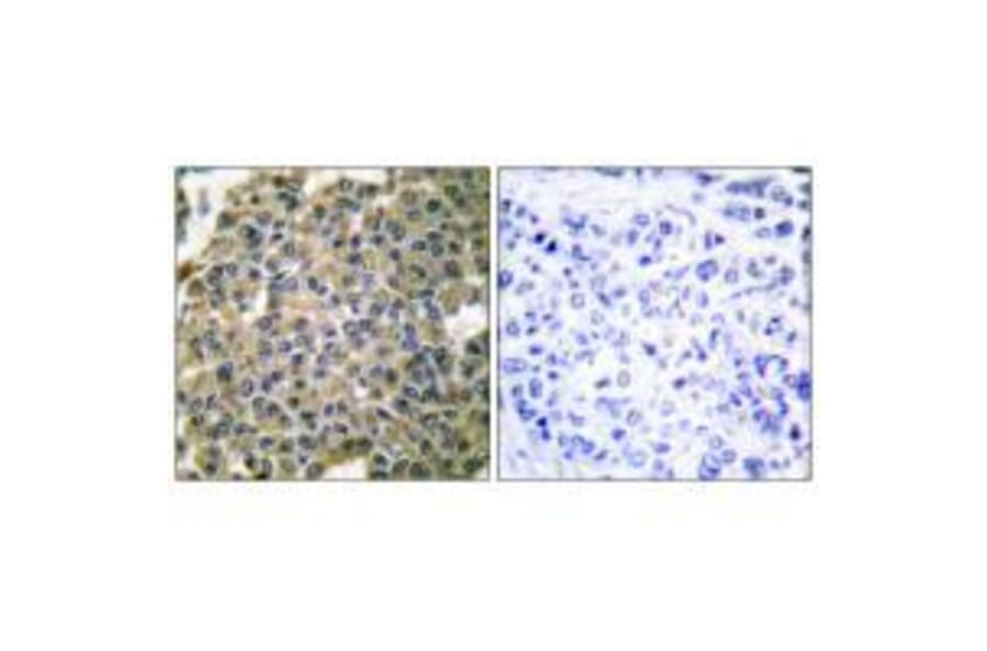 Immunohistochemistry - Keratin 7 Antibody from Signalway Antibody (33420) - Antibodies.com