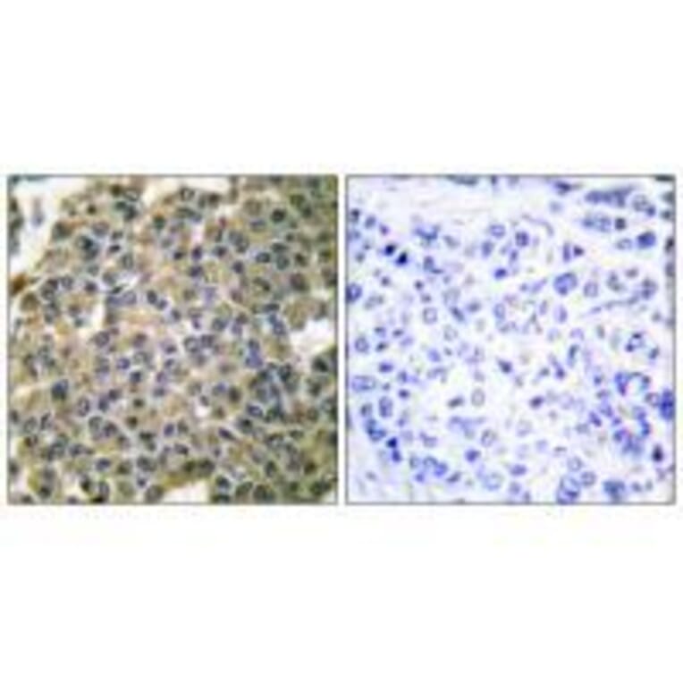 Immunohistochemistry - Keratin 7 Antibody from Signalway Antibody (33420) - Antibodies.com