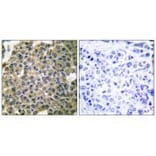 Immunohistochemistry - Keratin 7 Antibody from Signalway Antibody (33420) - Antibodies.com