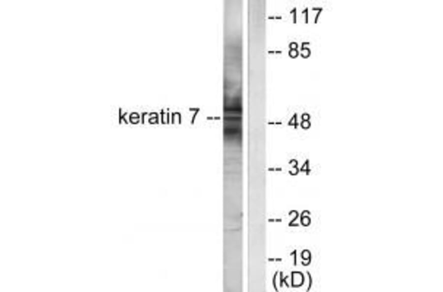 Western blot - Keratin 7 Antibody from Signalway Antibody (33420) - Antibodies.com