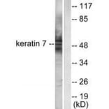 Western blot - Keratin 7 Antibody from Signalway Antibody (33420) - Antibodies.com