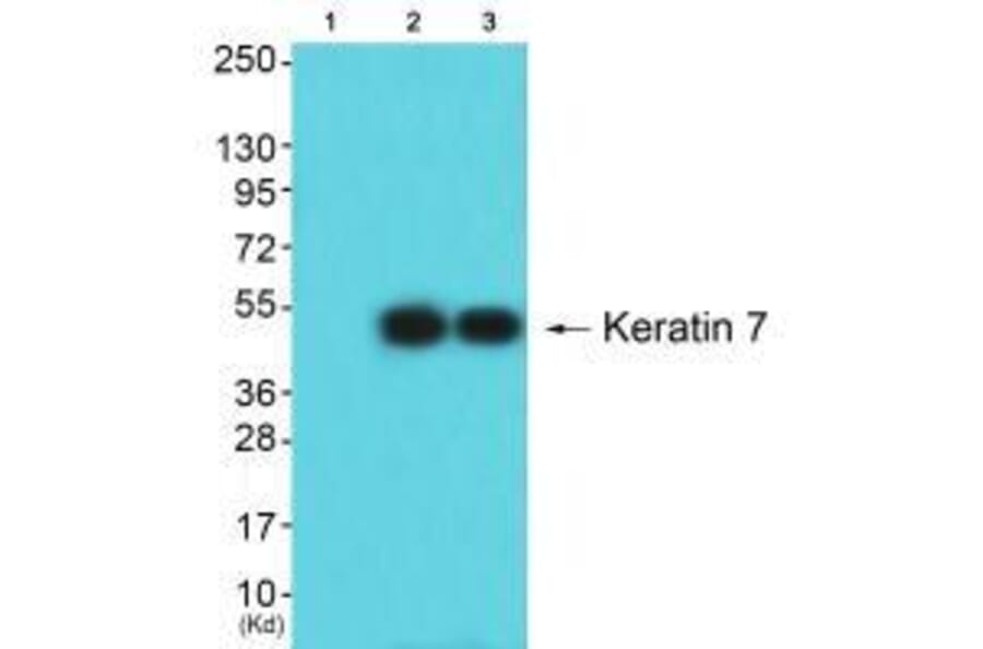 Western blot - Keratin 7 Antibody from Signalway Antibody (33420) - Antibodies.com