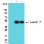 Western blot - Keratin 7 Antibody from Signalway Antibody (33420) - Antibodies.com