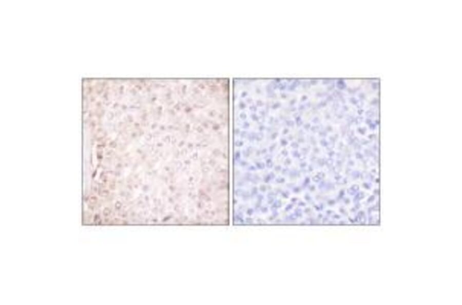 Immunohistochemistry - Stefin B Antibody from Signalway Antibody (33490) - Antibodies.com