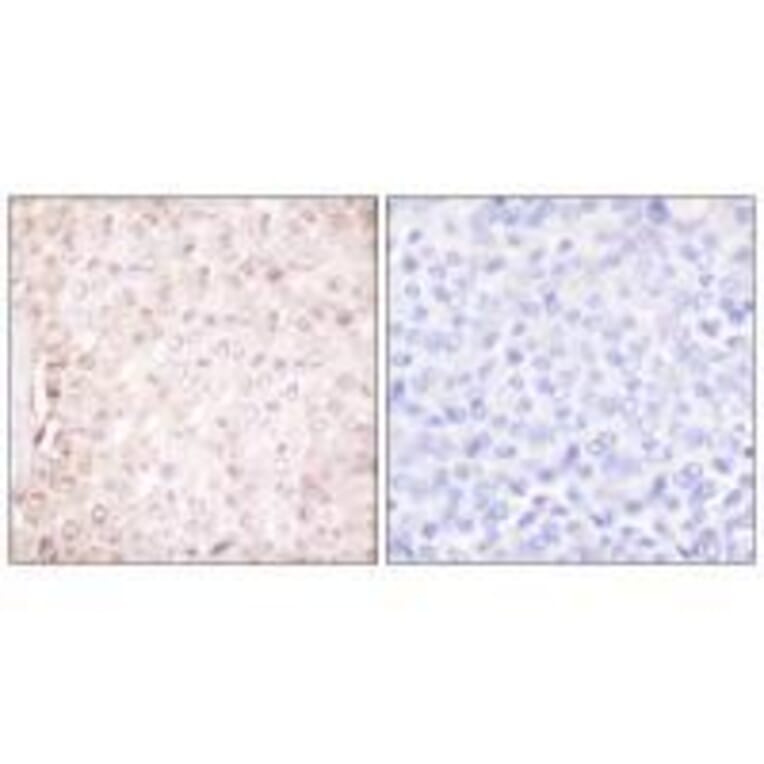 Immunohistochemistry - Stefin B Antibody from Signalway Antibody (33490) - Antibodies.com