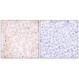 Immunohistochemistry - Stefin B Antibody from Signalway Antibody (33490) - Antibodies.com