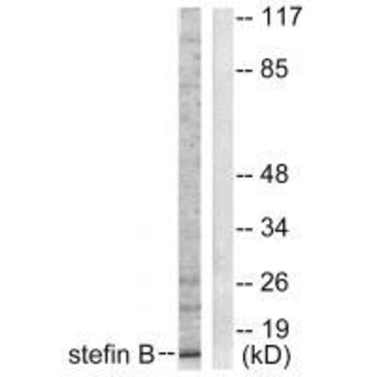 Western blot - Stefin B Antibody from Signalway Antibody (33490) - Antibodies.com