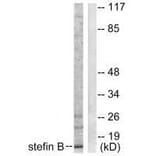 Western blot - Stefin B Antibody from Signalway Antibody (33490) - Antibodies.com