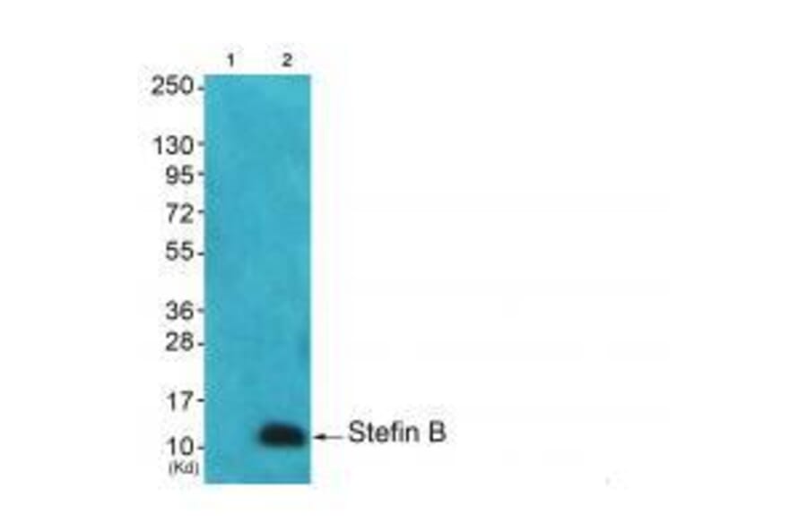 Western blot - Stefin B Antibody from Signalway Antibody (33490) - Antibodies.com