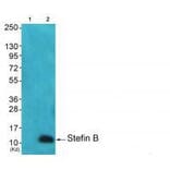 Western blot - Stefin B Antibody from Signalway Antibody (33490) - Antibodies.com