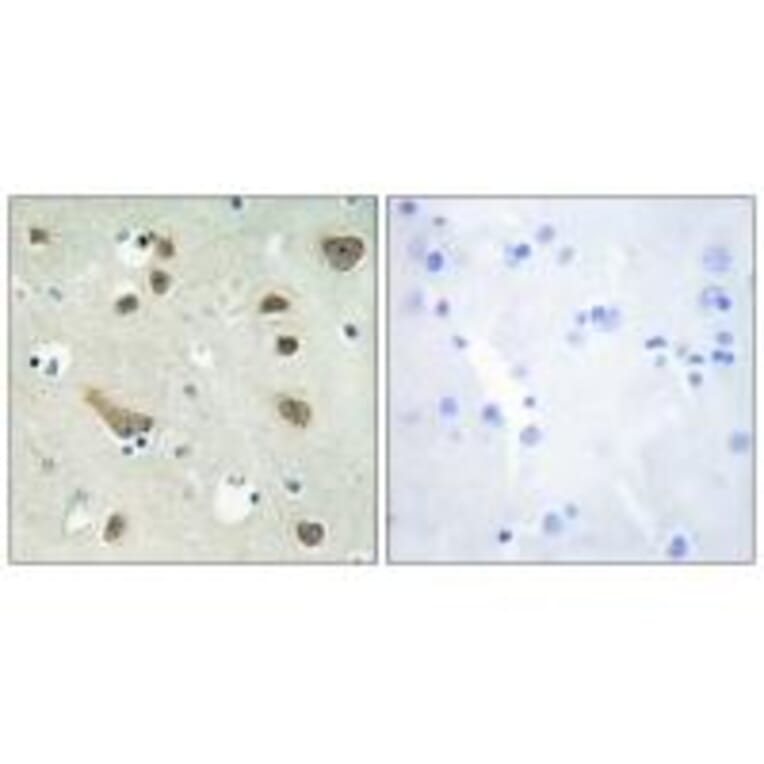 Immunohistochemistry - 14-3-3 γ Antibody from Signalway Antibody (34147) - Antibodies.com