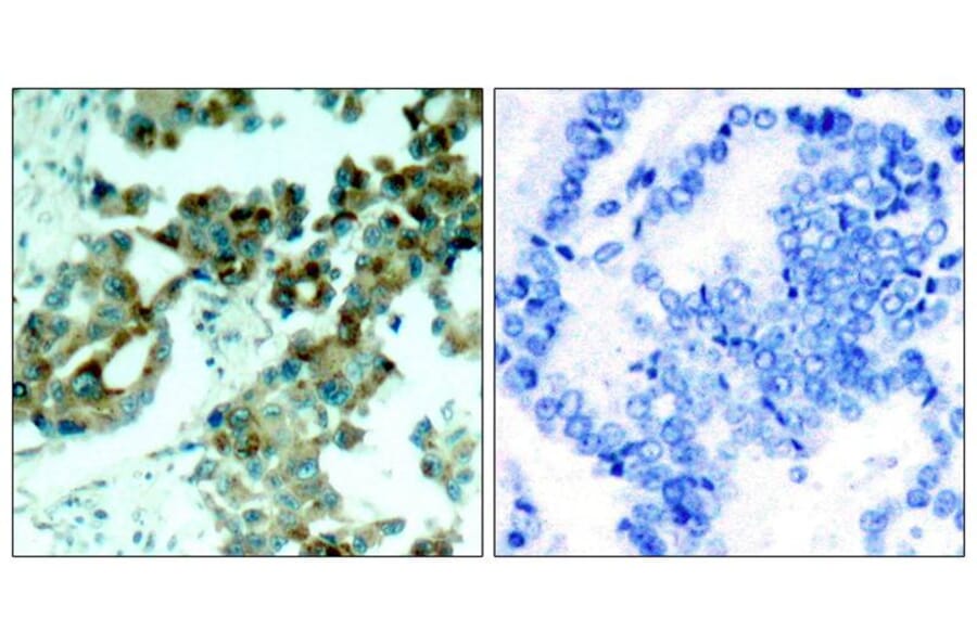 Immunohistochemistry - S6 Ribosomal Protein (Ab-235) Antibody from Signalway Antibody (21225) - Antibodies.com