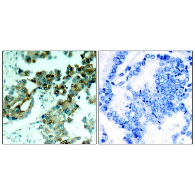 Immunohistochemistry - S6 Ribosomal Protein (Ab-235) Antibody from Signalway Antibody (21225) - Antibodies.com