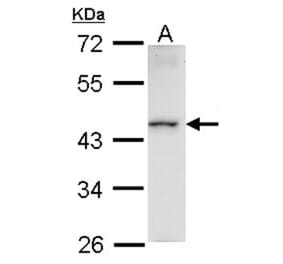 Homeobox-containing protein 1 antibody from Signalway Antibody (22616) - Antibodies.com