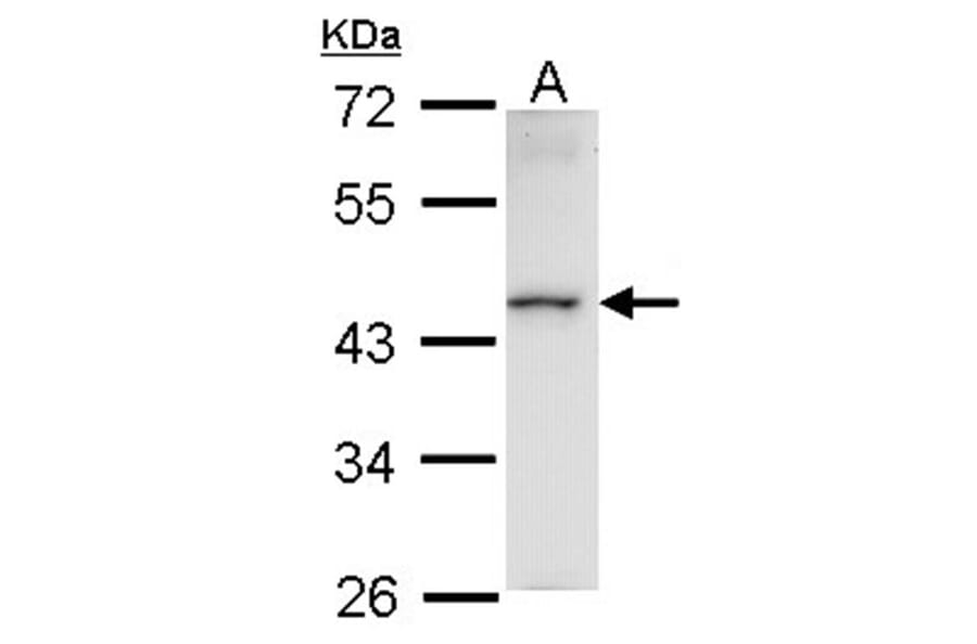 Homeobox-containing protein 1 antibody from Signalway Antibody (22616) - Antibodies.com