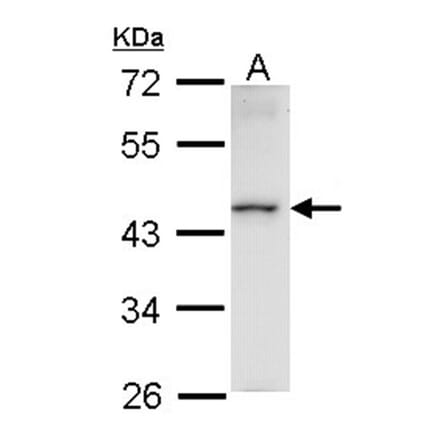 Homeobox-containing protein 1 antibody from Signalway Antibody (22616) - Antibodies.com
