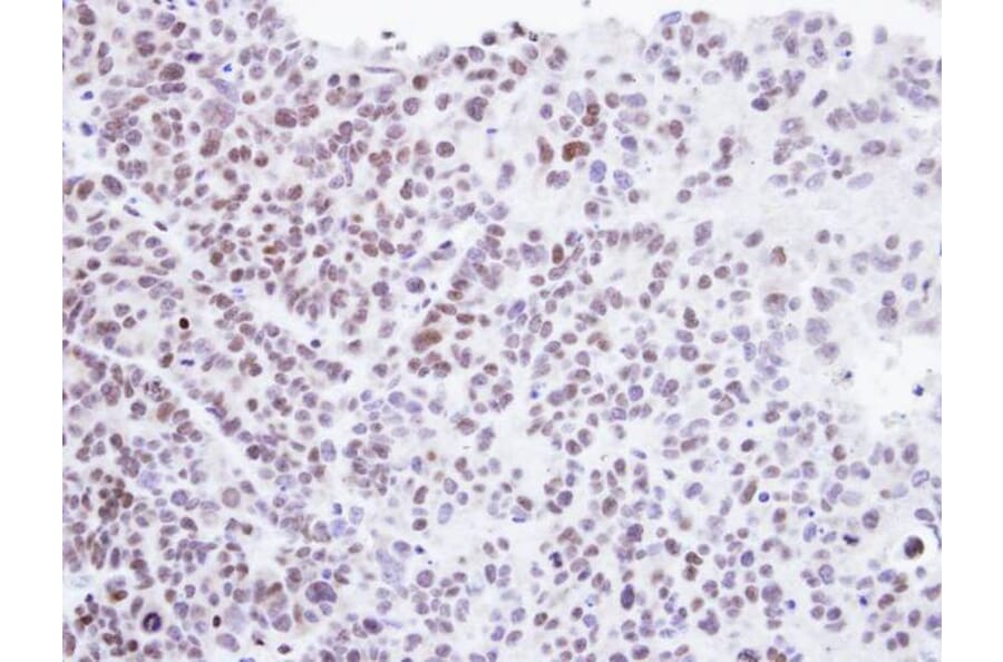 Immunohistochemistry - Homeobox-containing protein 1 antibody from Signalway Antibody (22616) - Antibodies.com