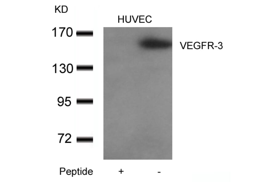 Western blot - VEGFR3 Antibody from Signalway Antibody (21410) - Antibodies.com