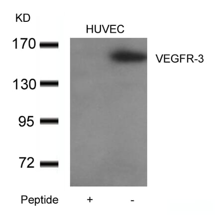 Western blot - VEGFR3 Antibody from Signalway Antibody (21410) - Antibodies.com