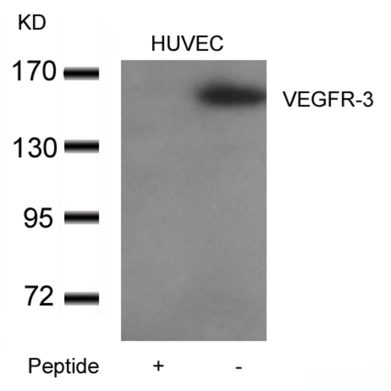 Western blot - VEGFR3 Antibody from Signalway Antibody (21410) - Antibodies.com