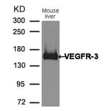 Western blot - VEGFR3 Antibody from Signalway Antibody (21410) - Antibodies.com