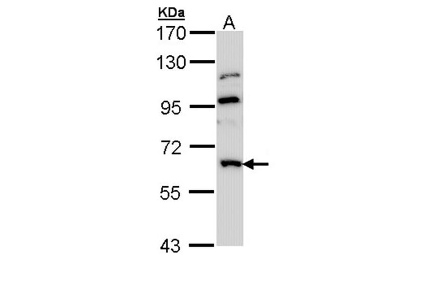 GnT-III antibody from Signalway Antibody (22062) - Antibodies.com