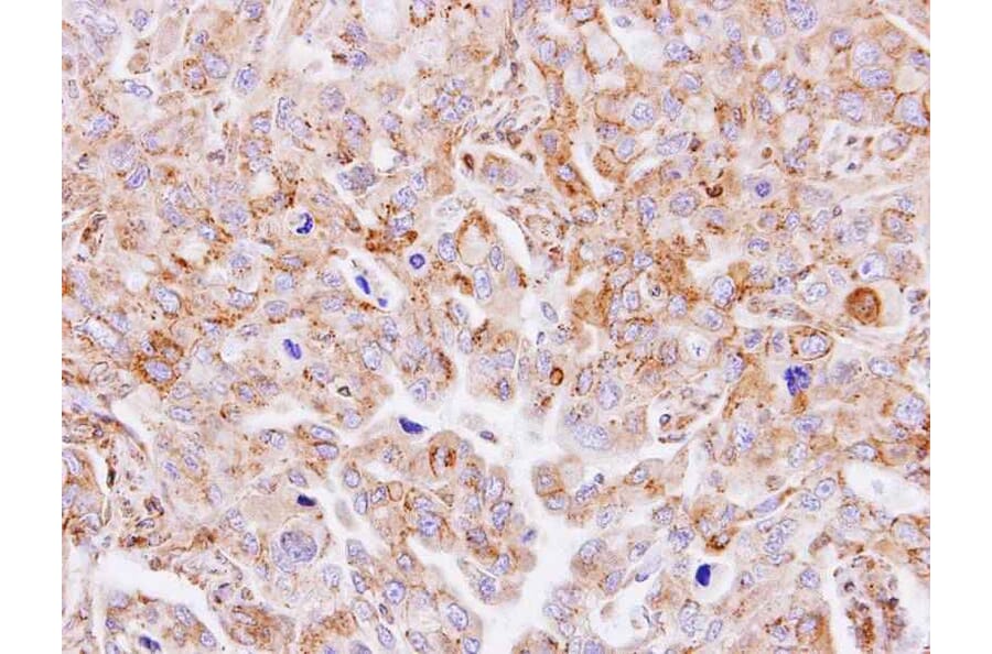 Immunohistochemistry - GnT-III antibody from Signalway Antibody (22062) - Antibodies.com