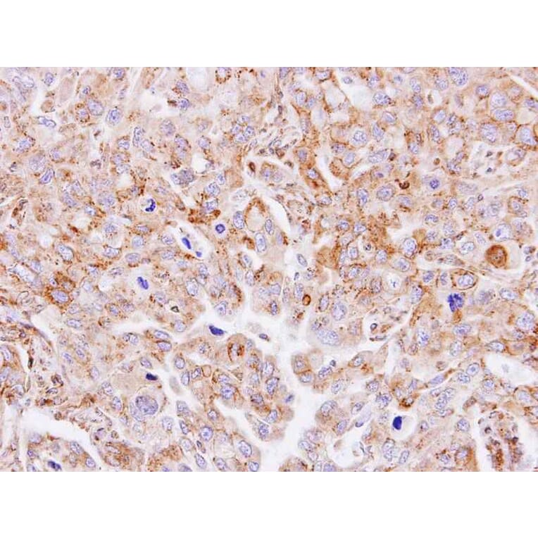 Immunohistochemistry - GnT-III antibody from Signalway Antibody (22062) - Antibodies.com